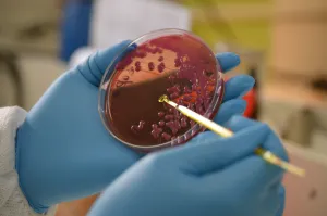 Petri Dish